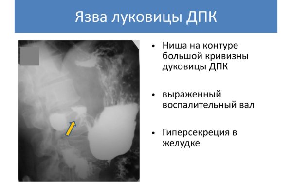 Работает ли кракен